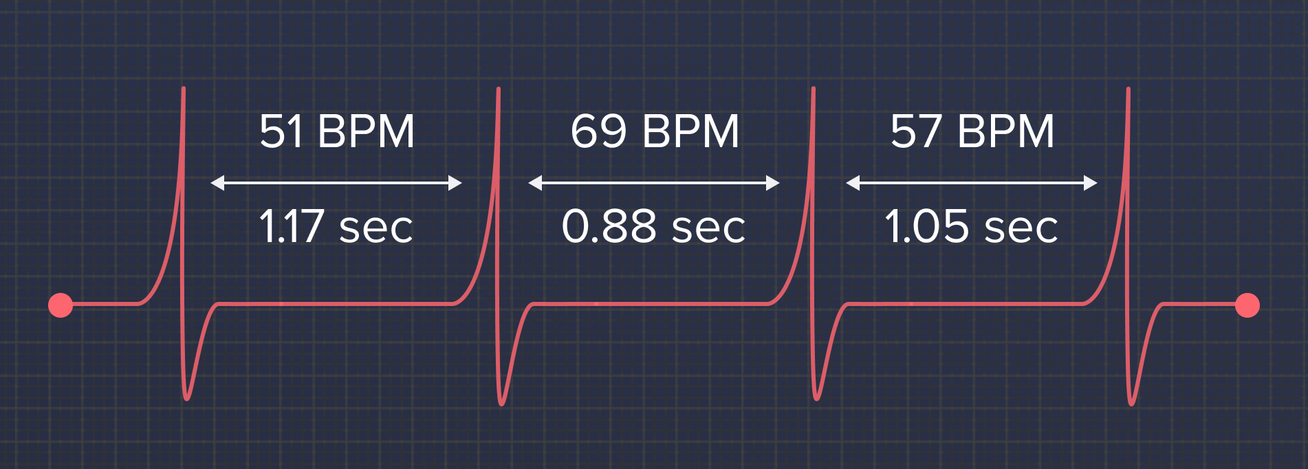 Вариабельность сердечного ритма. Вариабельности сердечного ритма (HRV). Вариабельность сердечного ритма картинки. Вариабельность сердечного ритма (HRV) рисунок. ВРМ измерении пульса что значит.
