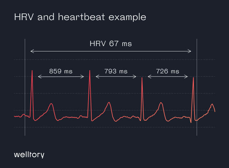 HRV and heartbeat example