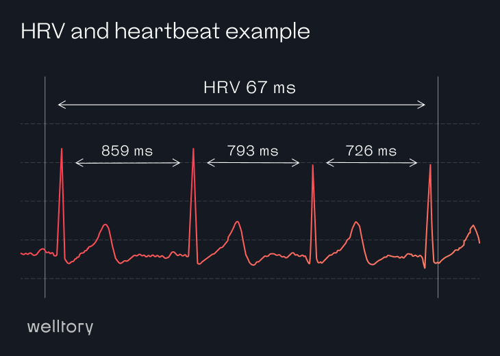 Race day heart rate variability (HRV)
